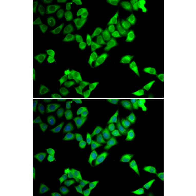 Immunofluorescence - Anti-Cip4 Antibody (A12060) - Antibodies.com