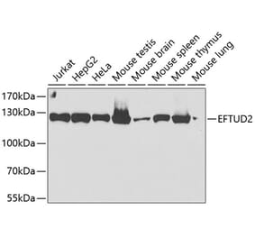 Western Blot - Anti-EFTUD2 Antibody (A12061) - Antibodies.com