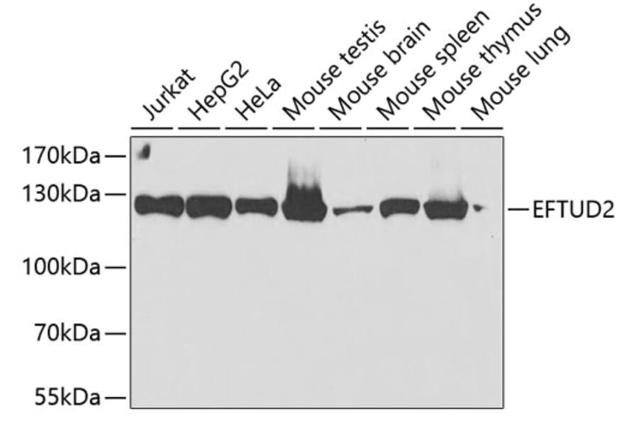 Western Blot - Anti-EFTUD2 Antibody (A12061) - Antibodies.com