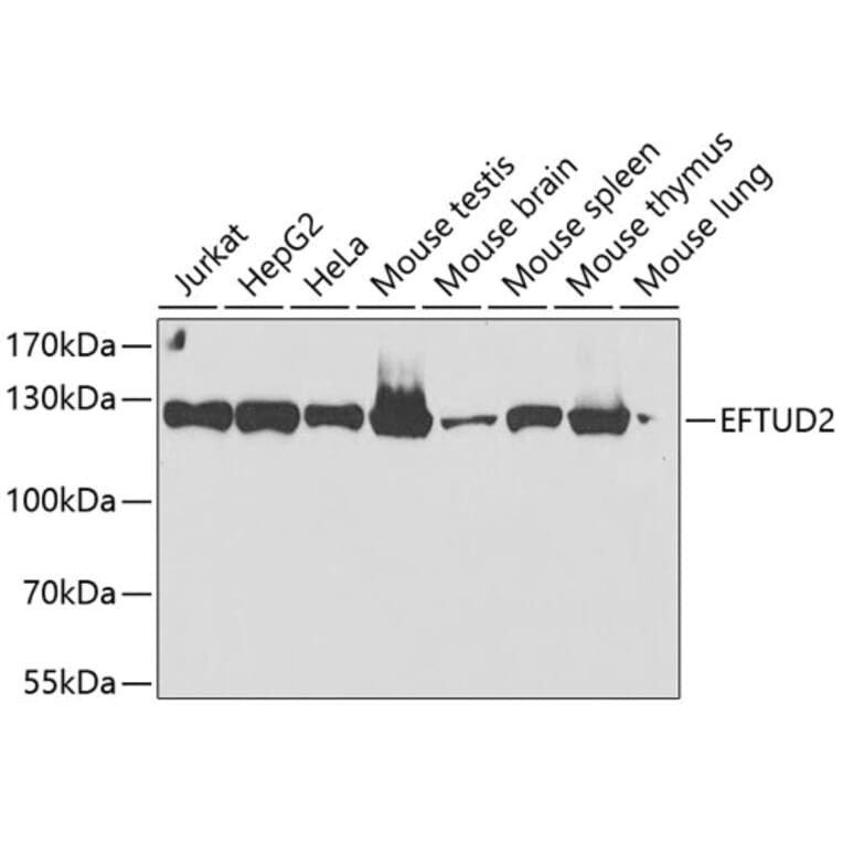 Western Blot - Anti-EFTUD2 Antibody (A12061) - Antibodies.com