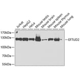 Western Blot - Anti-EFTUD2 Antibody (A12061) - Antibodies.com
