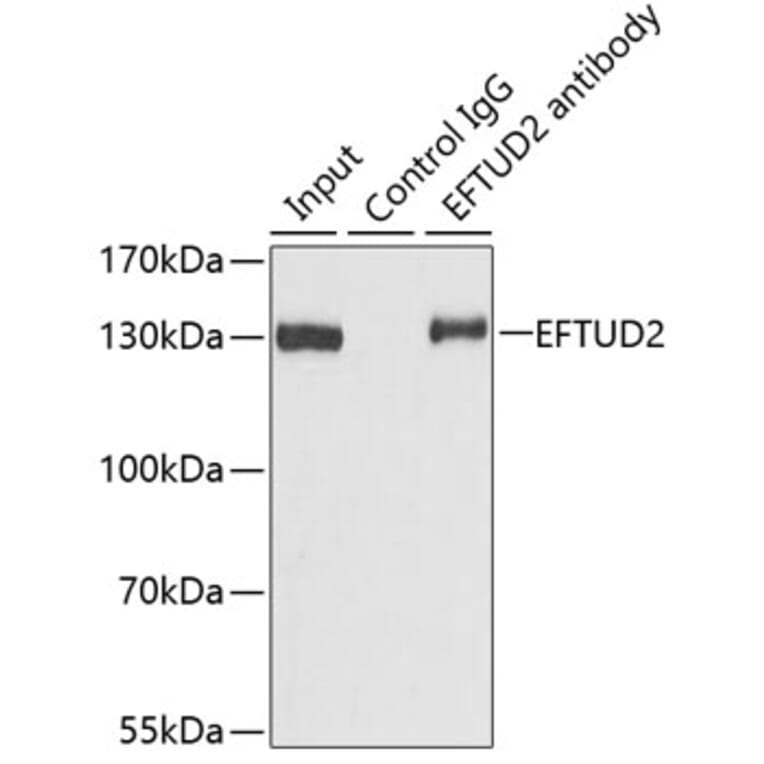 Western Blot - Anti-EFTUD2 Antibody (A12061) - Antibodies.com