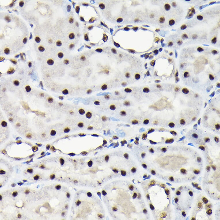 Immunohistochemistry - Anti-EFTUD2 Antibody (A12061) - Antibodies.com