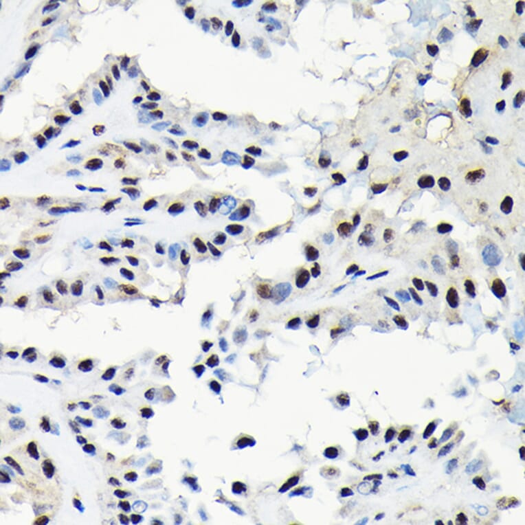 Immunohistochemistry - Anti-EFTUD2 Antibody (A12061) - Antibodies.com