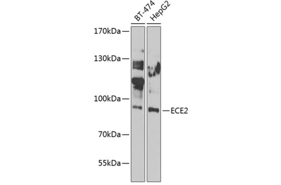 Western Blot - Anti-ECE2 Antibody (A7049) - Antibodies.com