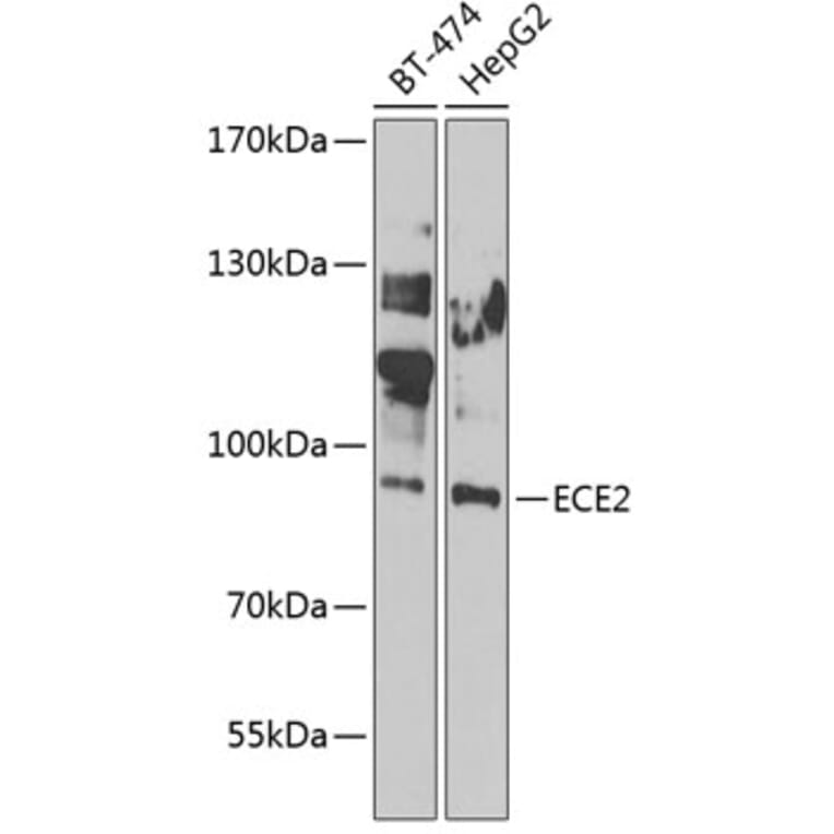 Western Blot - Anti-ECE2 Antibody (A7049) - Antibodies.com