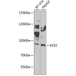 Western Blot - Anti-ECE2 Antibody (A7049) - Antibodies.com