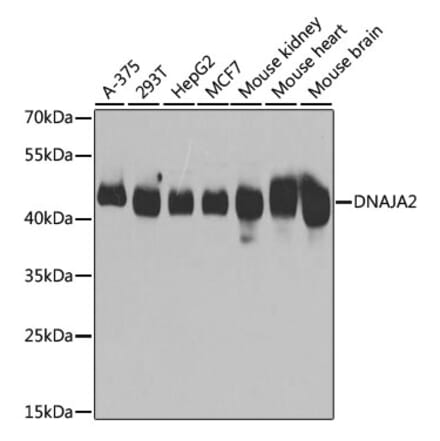 Western Blot - Anti-DNAJA2 Antibody (A12063) - Antibodies.com