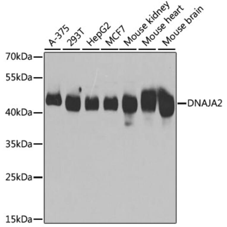 Western Blot - Anti-DNAJA2 Antibody (A12063) - Antibodies.com