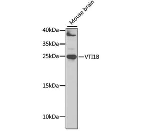 Western Blot - Anti-VTI1B Antibody (A12064) - Antibodies.com