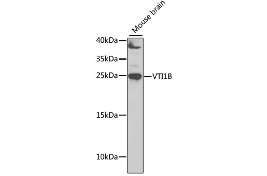 Western Blot - Anti-VTI1B Antibody (A12064) - Antibodies.com