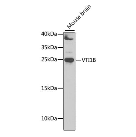 Western Blot - Anti-VTI1B Antibody (A12064) - Antibodies.com