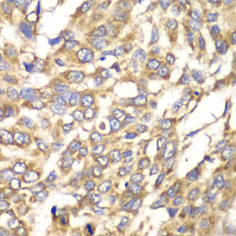 Immunohistochemistry - Anti-VTI1B Antibody (A12064) - Antibodies.com