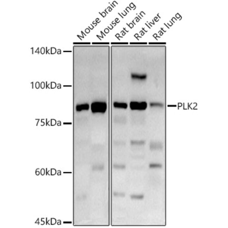 Western Blot - Anti-PLK2 Antibody (A12065) - Antibodies.com