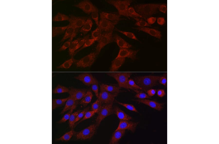 Immunofluorescence - Anti-PLK2 Antibody (A12065) - Antibodies.com