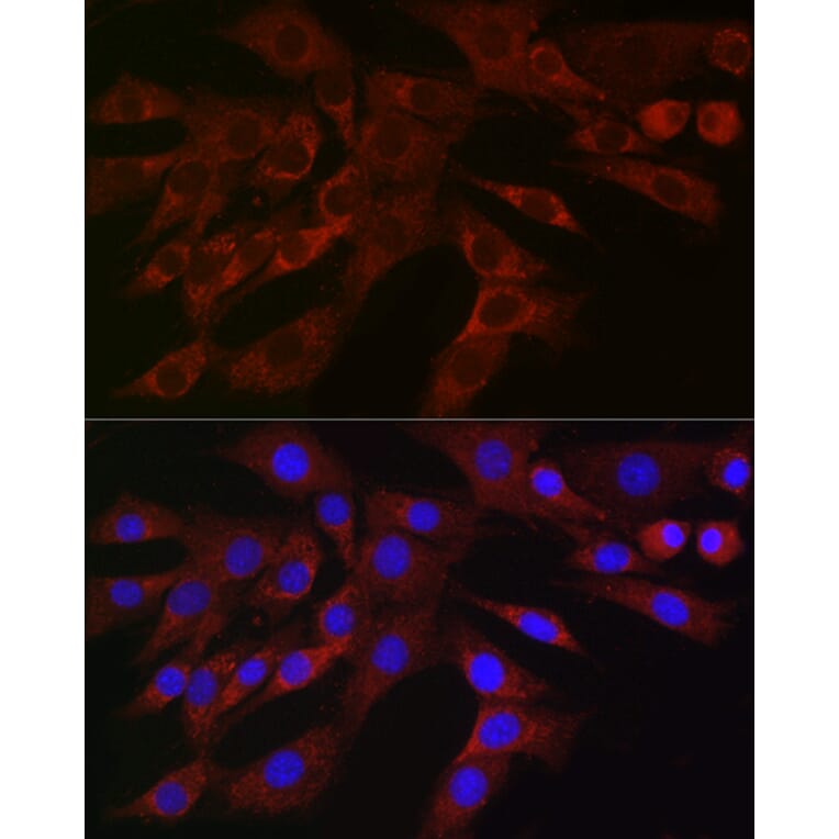 Immunofluorescence - Anti-PLK2 Antibody (A12065) - Antibodies.com