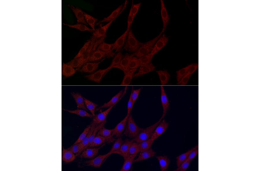 Immunofluorescence - Anti-PLK2 Antibody (A12065) - Antibodies.com