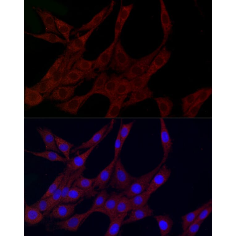 Immunofluorescence - Anti-PLK2 Antibody (A12065) - Antibodies.com