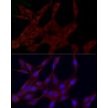 Immunofluorescence - Anti-PLK2 Antibody (A12065) - Antibodies.com