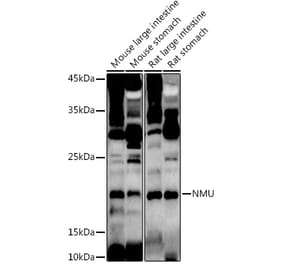 Western Blot - Anti-NMU Antibody (A12066) - Antibodies.com
