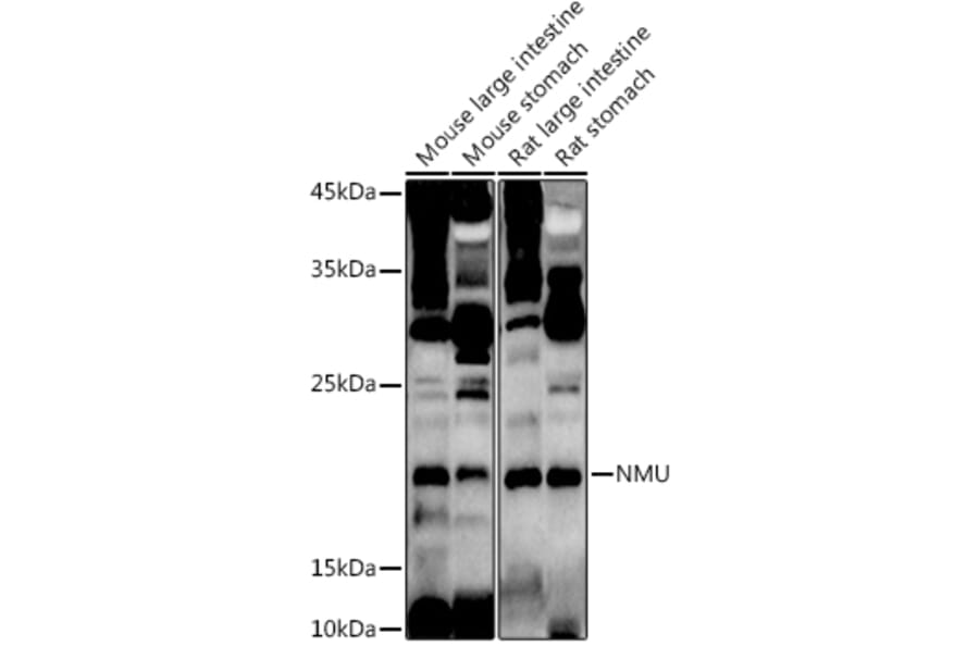Western Blot - Anti-NMU Antibody (A12066) - Antibodies.com
