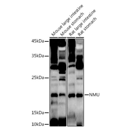 Western Blot - Anti-NMU Antibody (A12066) - Antibodies.com