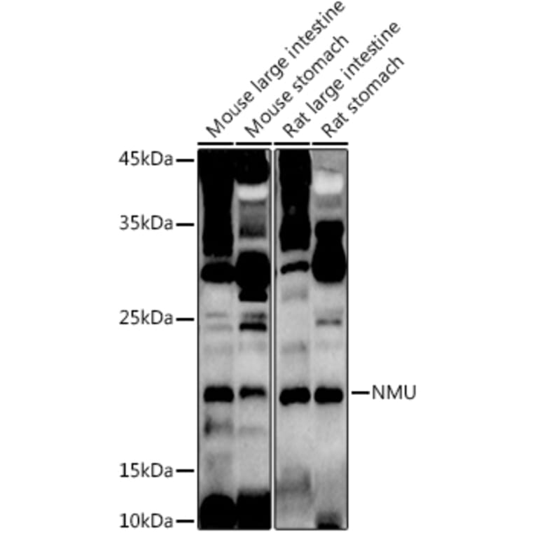 Western Blot - Anti-NMU Antibody (A12066) - Antibodies.com