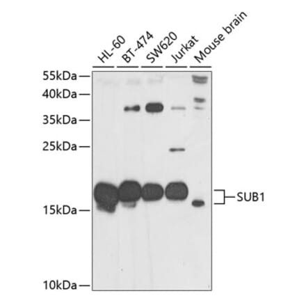 Western Blot - Anti-PC4 Antibody (A12067) - Antibodies.com