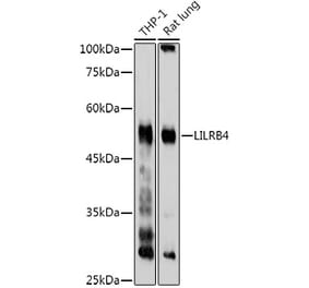 Western Blot - Anti-ILT-3 Antibody (A12068) - Antibodies.com