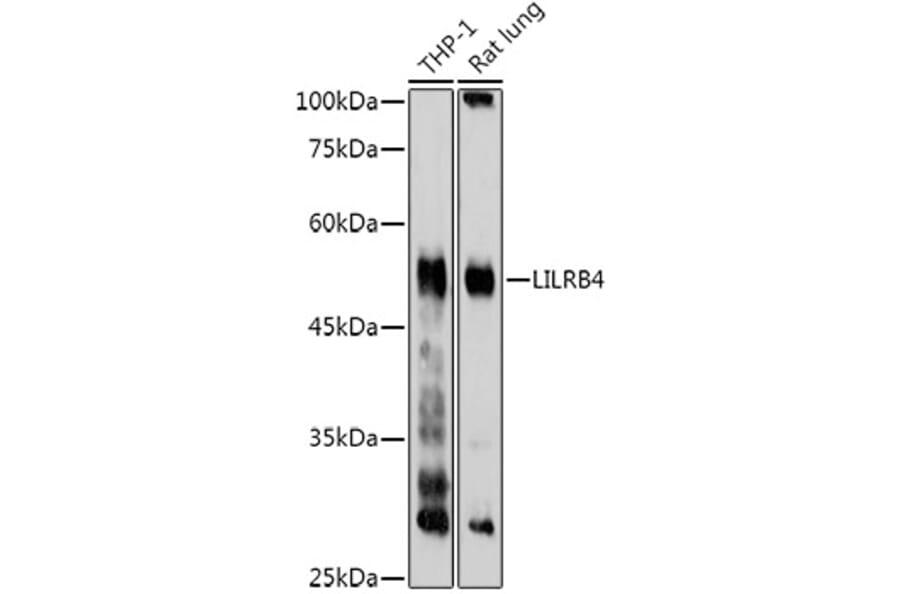 Western Blot - Anti-ILT-3 Antibody (A12068) - Antibodies.com