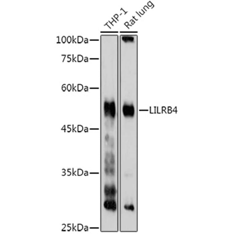 Western Blot - Anti-ILT-3 Antibody (A12068) - Antibodies.com