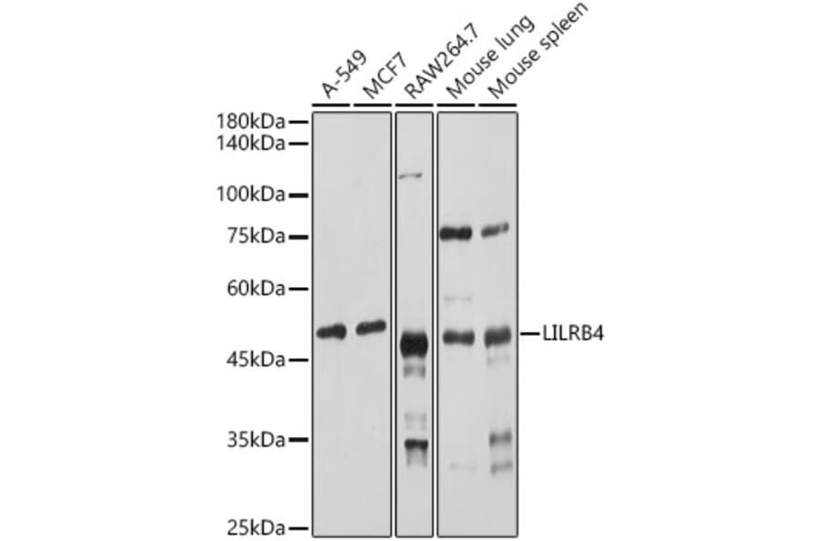 Western Blot - Anti-ILT-3 Antibody (A12068) - Antibodies.com