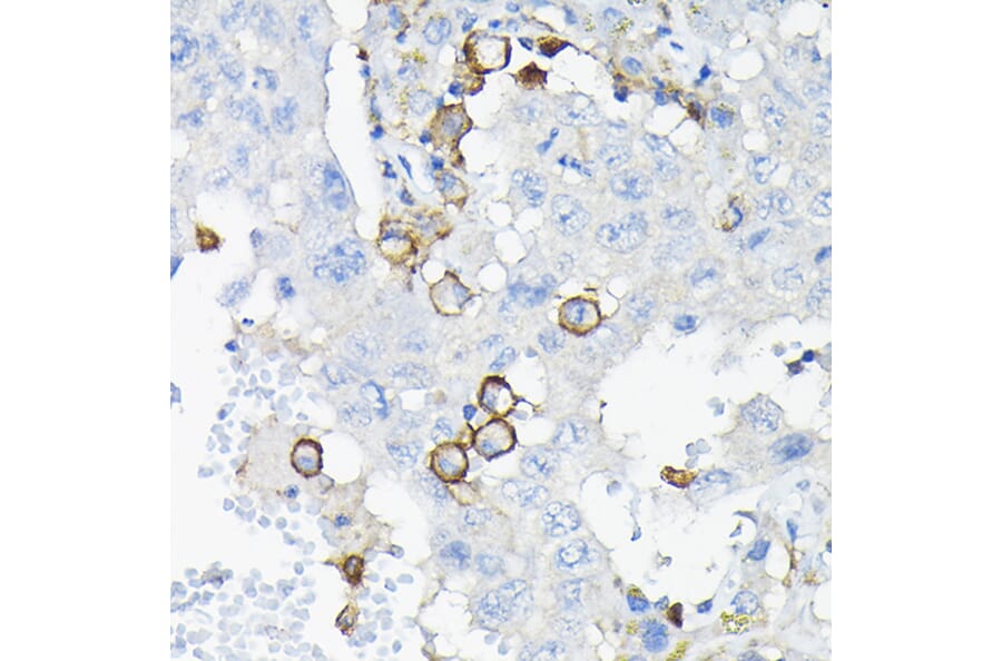 Immunohistochemistry - Anti-ILT-3 Antibody (A12068) - Antibodies.com