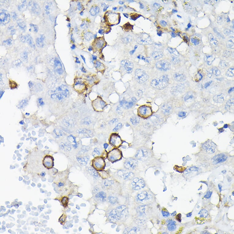 Immunohistochemistry - Anti-ILT-3 Antibody (A12068) - Antibodies.com