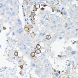 Immunohistochemistry - Anti-ILT-3 Antibody (A12068) - Antibodies.com