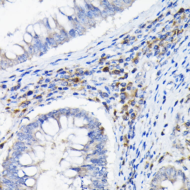 Immunohistochemistry - Anti-ILT-3 Antibody (A12068) - Antibodies.com