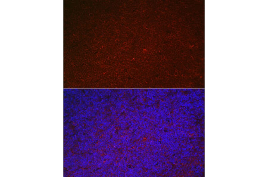 Immunofluorescence - Anti-ILT-3 Antibody (A12068) - Antibodies.com
