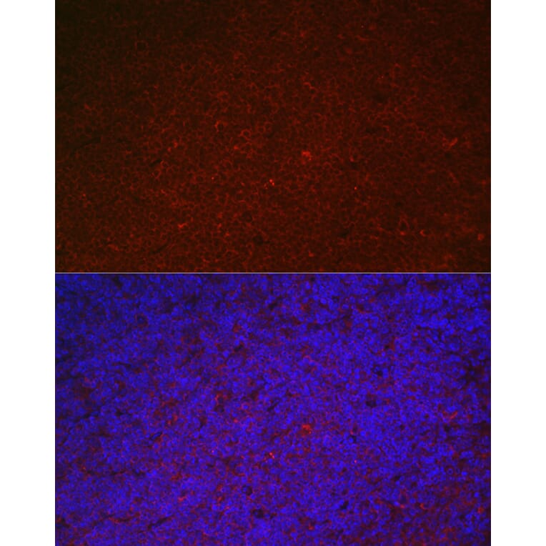 Immunofluorescence - Anti-ILT-3 Antibody (A12068) - Antibodies.com