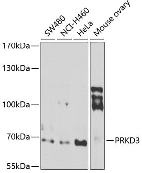 Western blot analysis of extracts of various cell lines, using Anti-PRKD3 Antibody (A7084) at 1:1,000 dilution.
Secondary antibody: Goat Anti-Rabbit IgG (H+L) (HRP) (AS014) at 1:10,000 dilution.
Lysates / proteins: 25µg per lane.
Blocking buffer: 3% non-fat dry milk in TBST.
Detection: ECL Basic Kit (RM00020).
Exposure time: 90s.