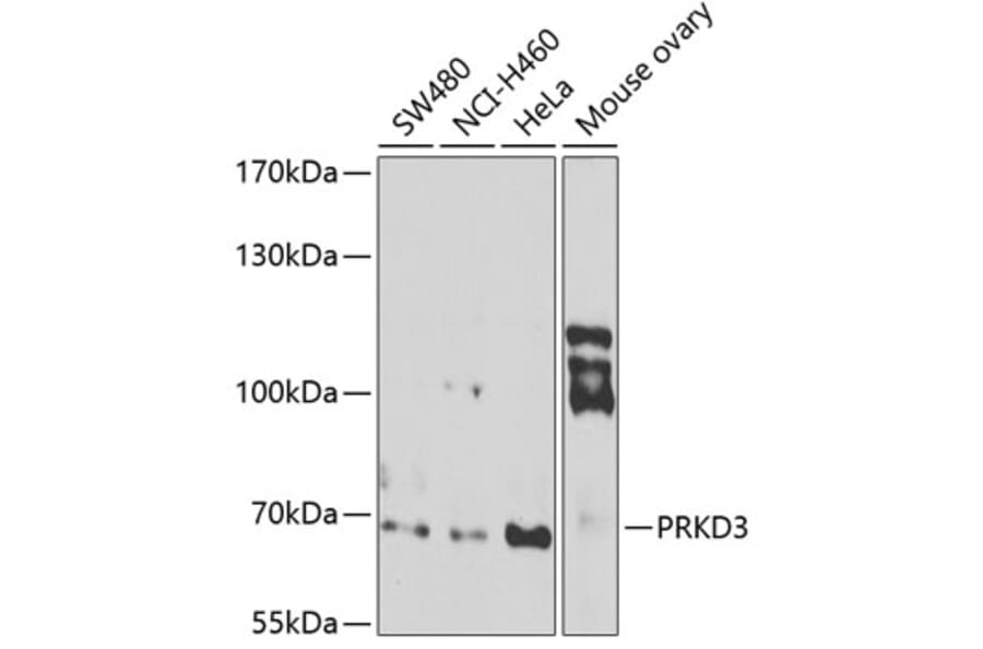 Western Blot - Anti-PKC nu/PRKD3 Antibody (A12069) - Antibodies.com
