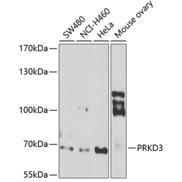 Western Blot - Anti-PKC nu/PRKD3 Antibody (A12069) - Antibodies.com