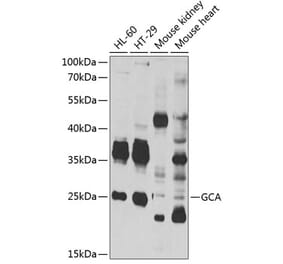 Western Blot - Anti-Grancalcin Antibody (A12070) - Antibodies.com