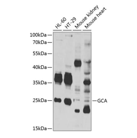 Western Blot - Anti-Grancalcin Antibody (A12070) - Antibodies.com