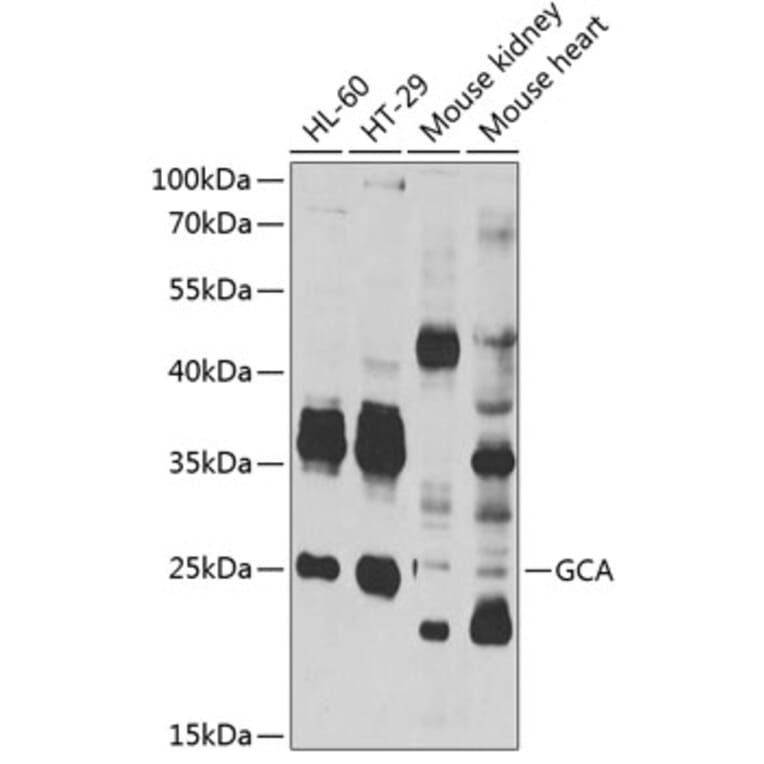 Western Blot - Anti-Grancalcin Antibody (A12070) - Antibodies.com
