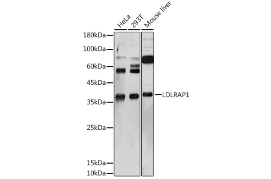 Western Blot - Anti-ARH Antibody (A12071) - Antibodies.com