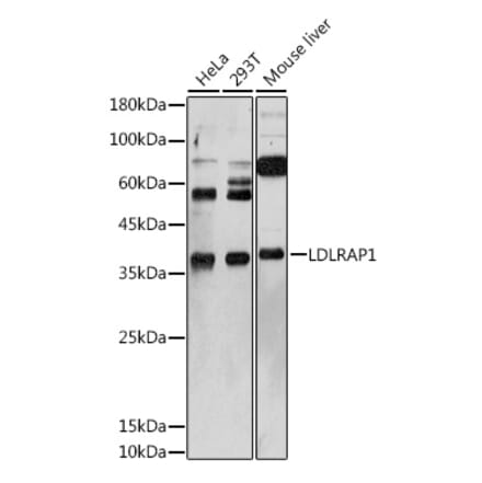 Western Blot - Anti-ARH Antibody (A12071) - Antibodies.com