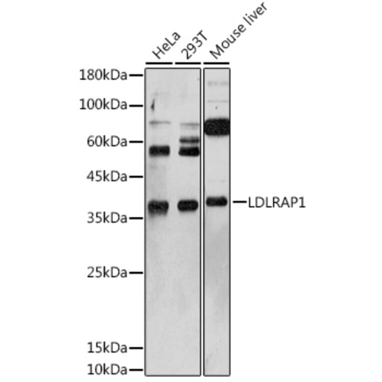 Western Blot - Anti-ARH Antibody (A12071) - Antibodies.com