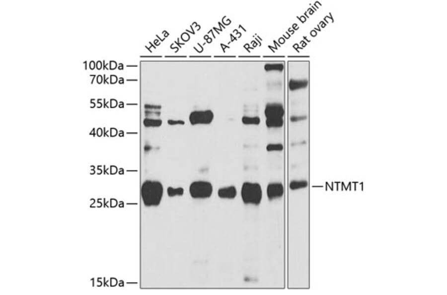Western Blot - Anti-METTL11A Antibody (A12072) - Antibodies.com
