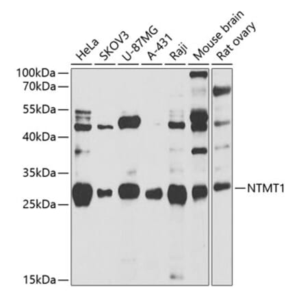 Western Blot - Anti-METTL11A Antibody (A12072) - Antibodies.com