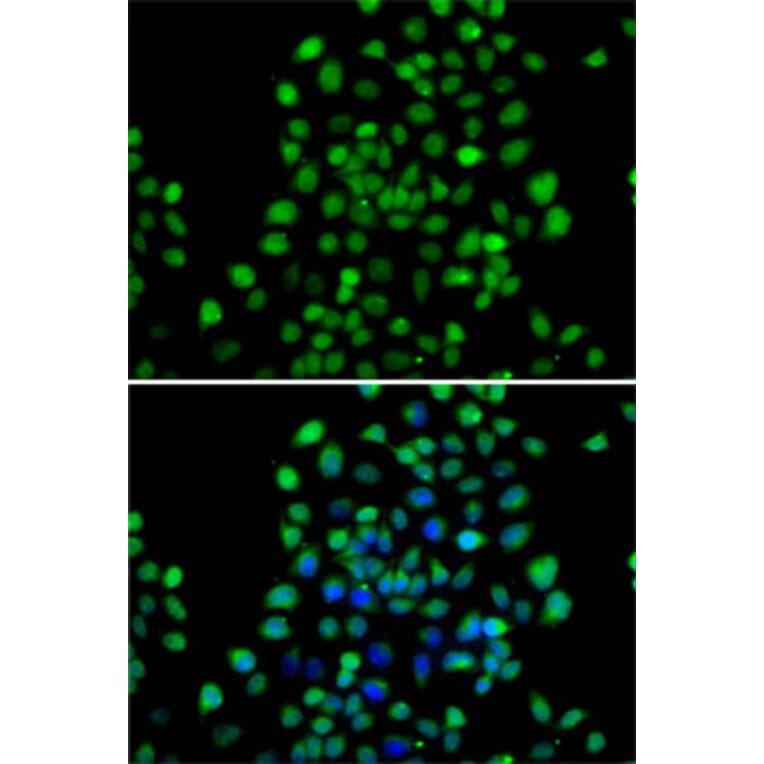 Immunofluorescence - Anti-METTL11A Antibody (A12072) - Antibodies.com